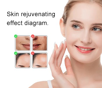 Vilken är bättre mandelsyra eller niacinamid?