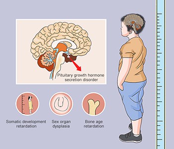 Vill du att ditt barn ska --hoppa upp? Är tillväxthormon pålitligt?