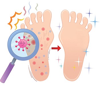 Kan idrottsman foten verkligen spridas till händerna?