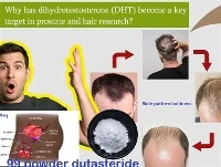 Varför har DHT blivit ett nyckelmål inom prostata- och hårforskning